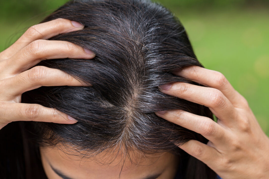 Young woman shows her gray hair roots